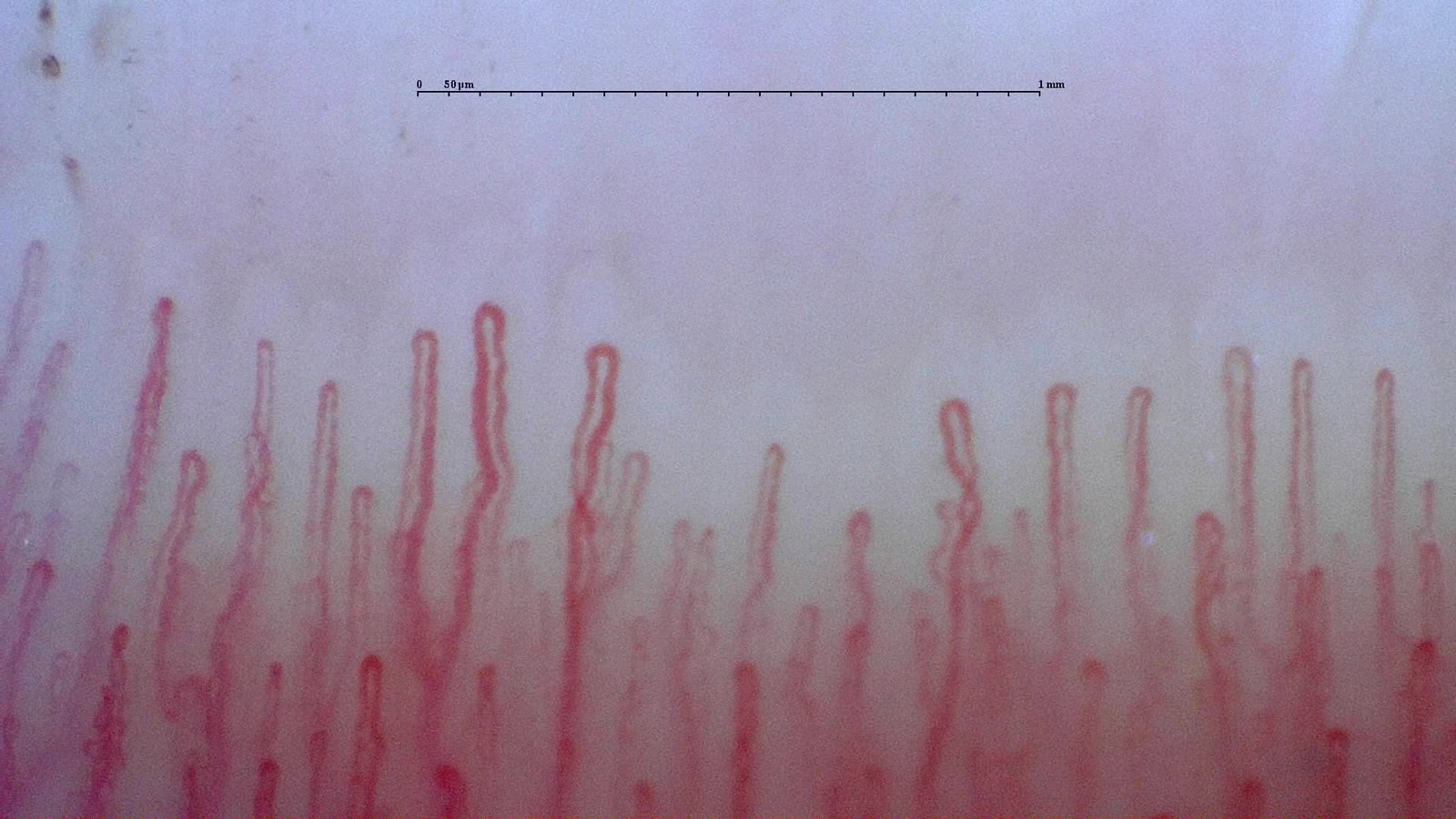 Image correctly centered on the first capillary row