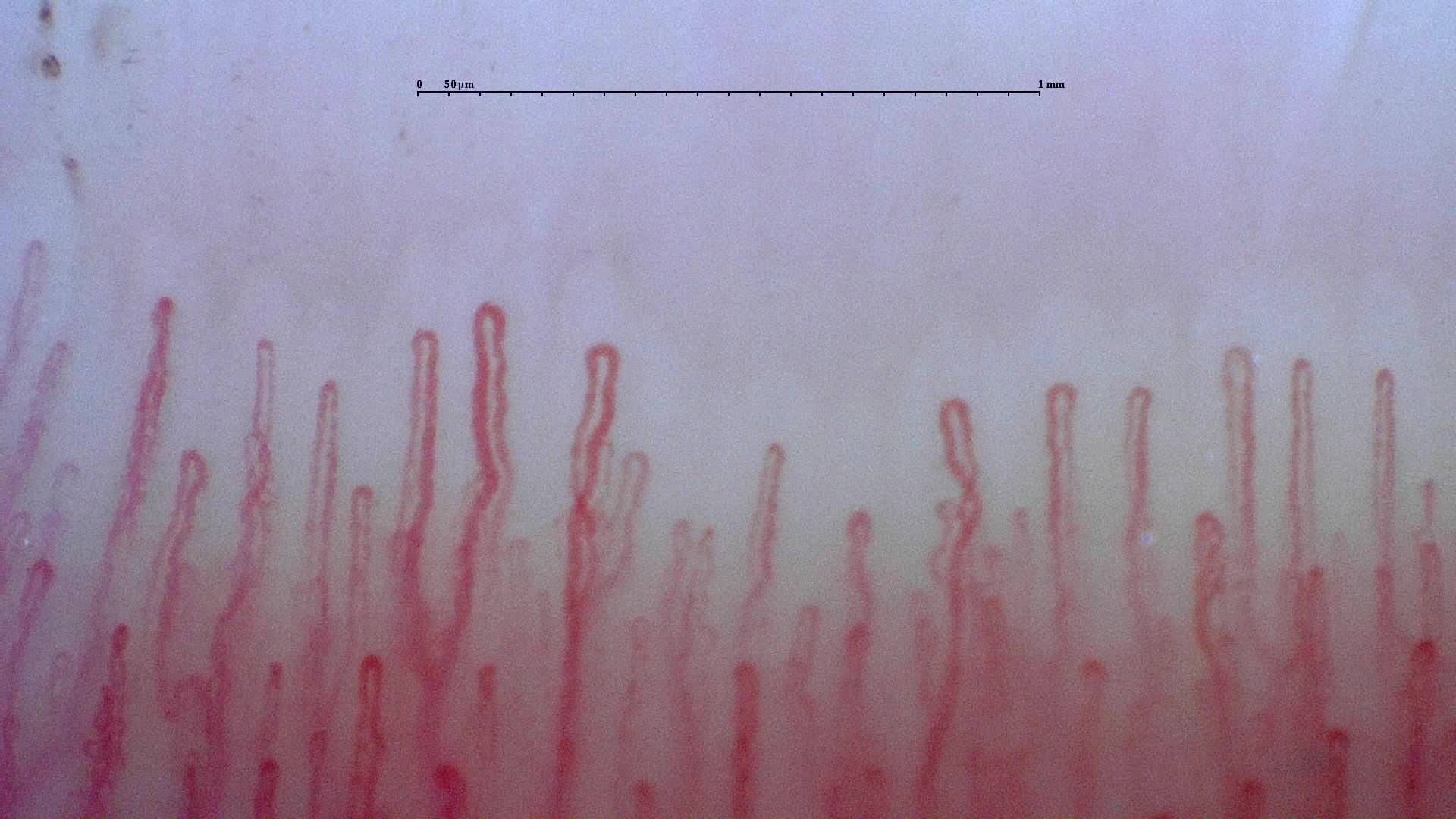 Correctly acquired capillaroscopy image