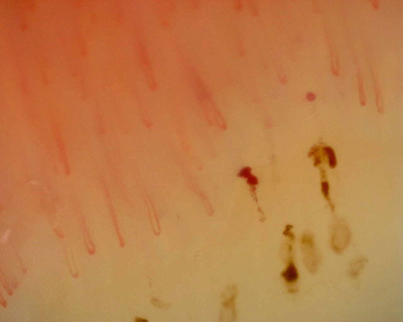 Non-Specific Pattern: Representative Case