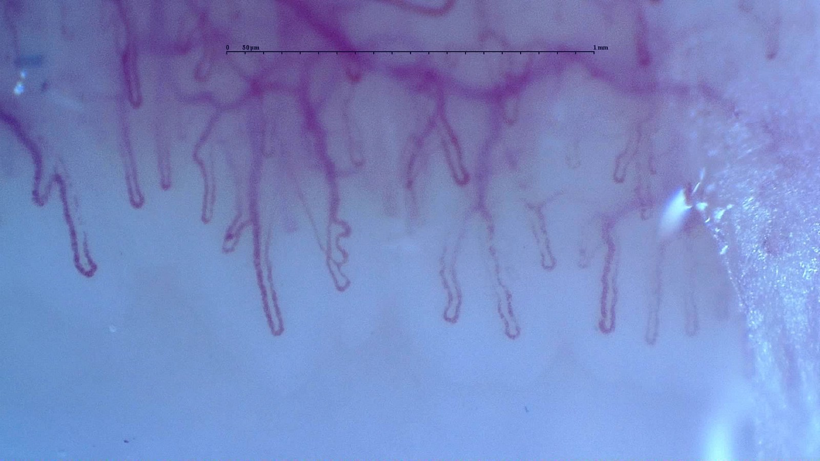 Reduced capillary density