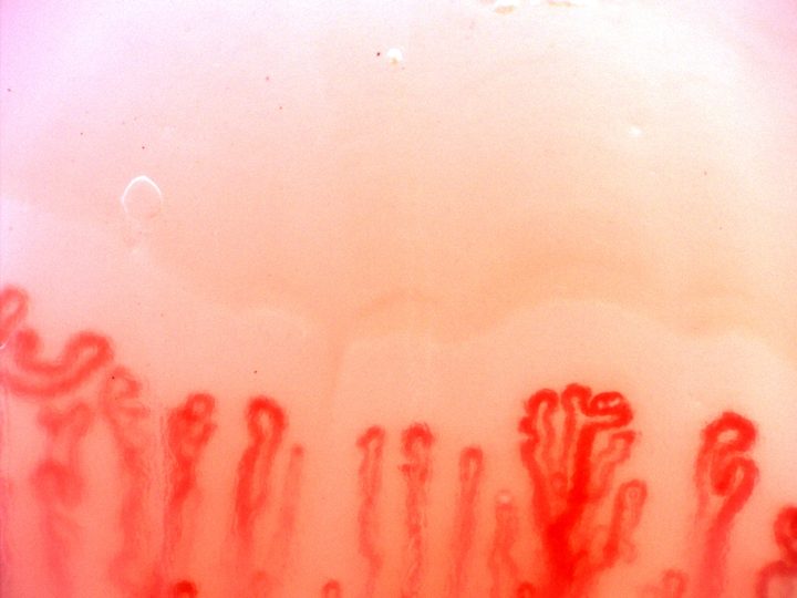 Capillaries with multiple rounded apices that appear connected to a common base, beside simple and folded loops.