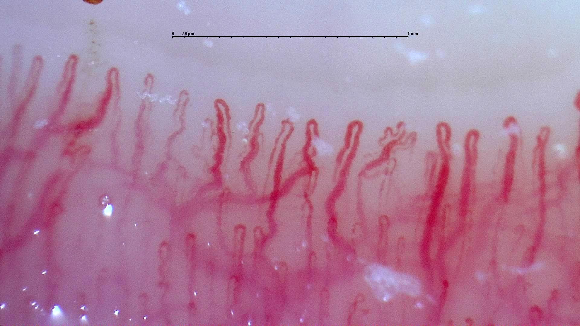 A small capillary with multiple apices right of center, beside taller hairpin loops and tortuous limbs.
