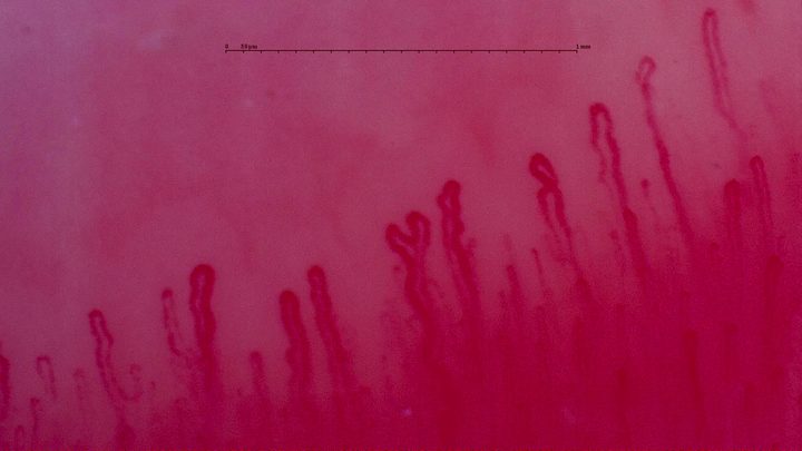 A capillary with two rounded apices in the center, beside broader hairpin loops and some crossed or twisted capillaries.
