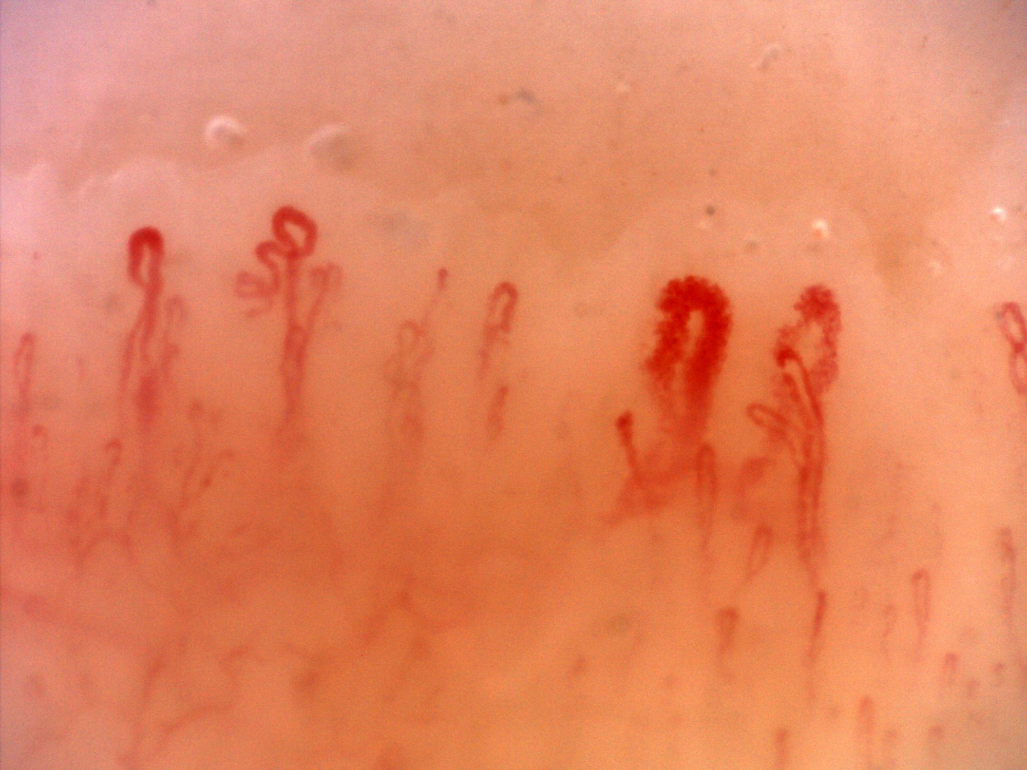 A giant-appearing capillary right of center, with smaller accessory loops and curved apices nearby.