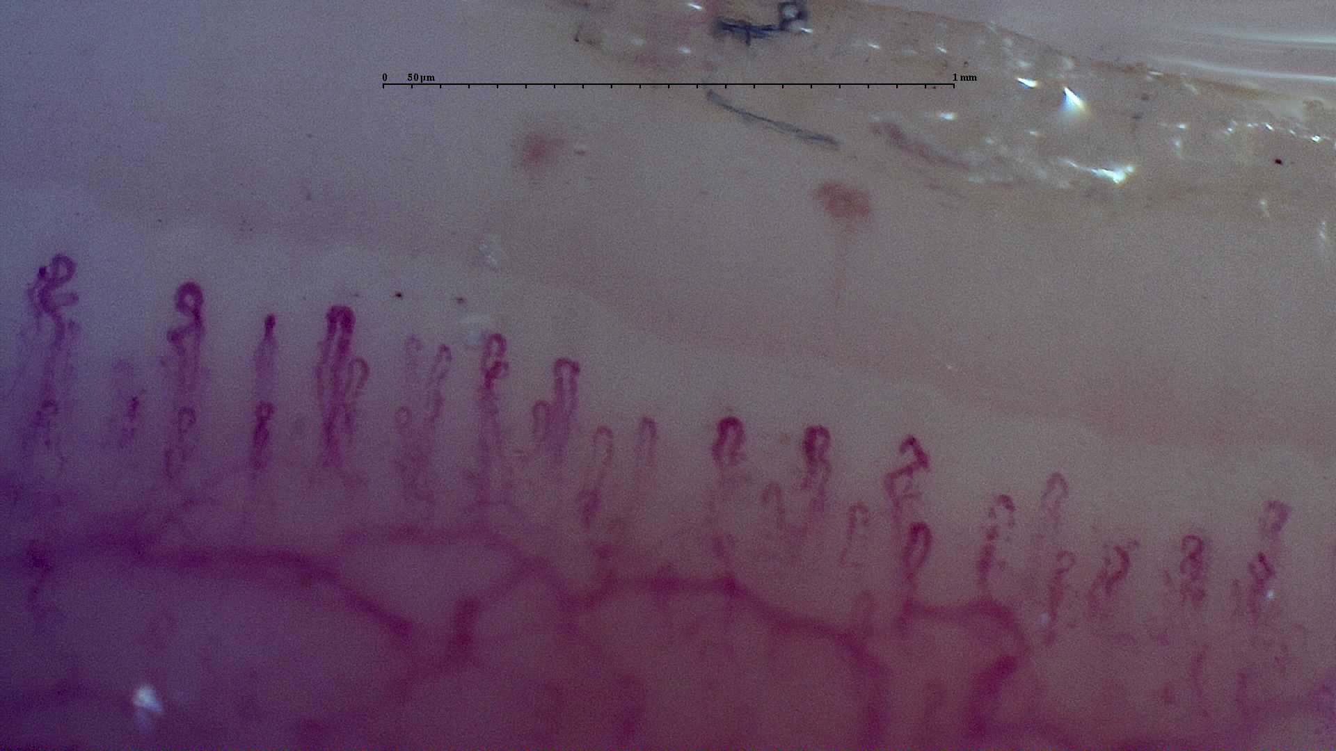 Small coiled and folded capillary apices. Separate reddish deposits compatible with microhemorrhages lie above the row.