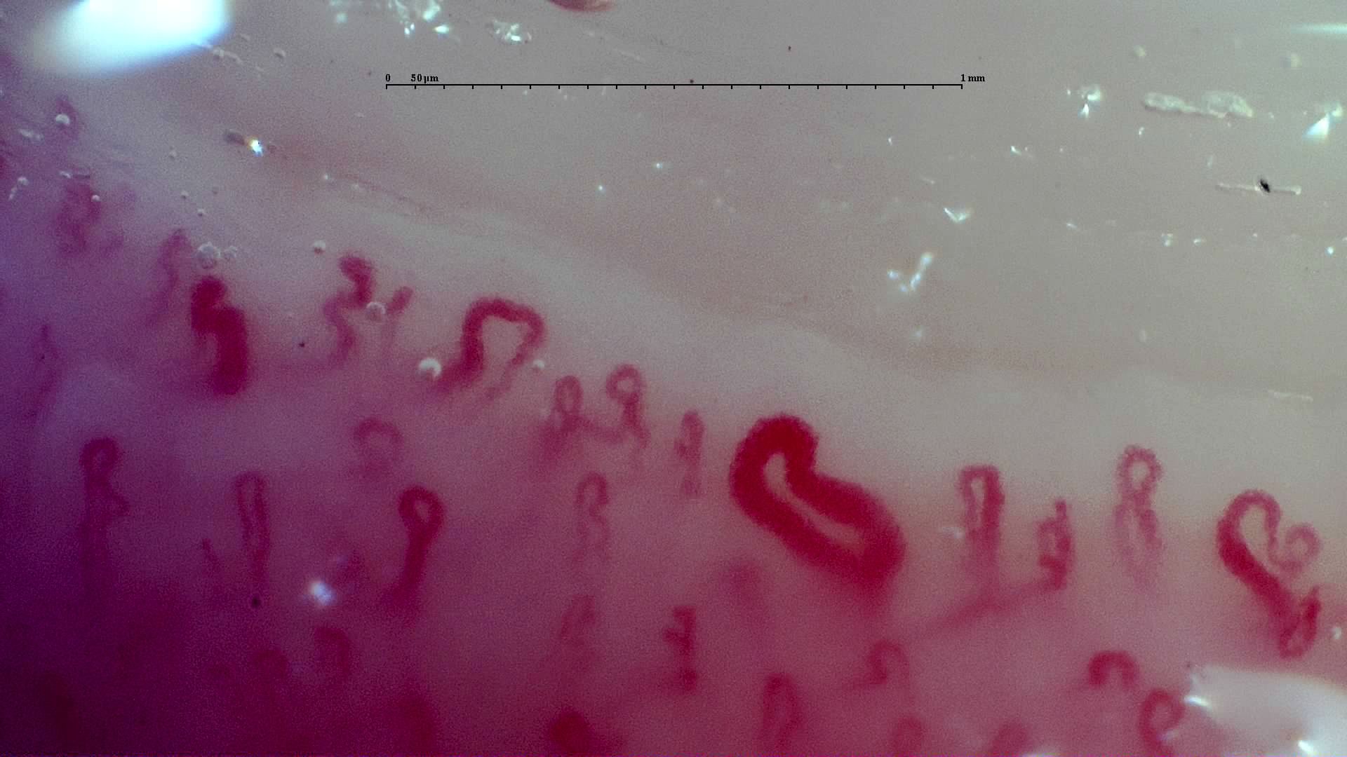 A tortuous giant-appearing capillary near the center-right, with a thick apex and limbs. Smaller coiled loops are visible nearby.