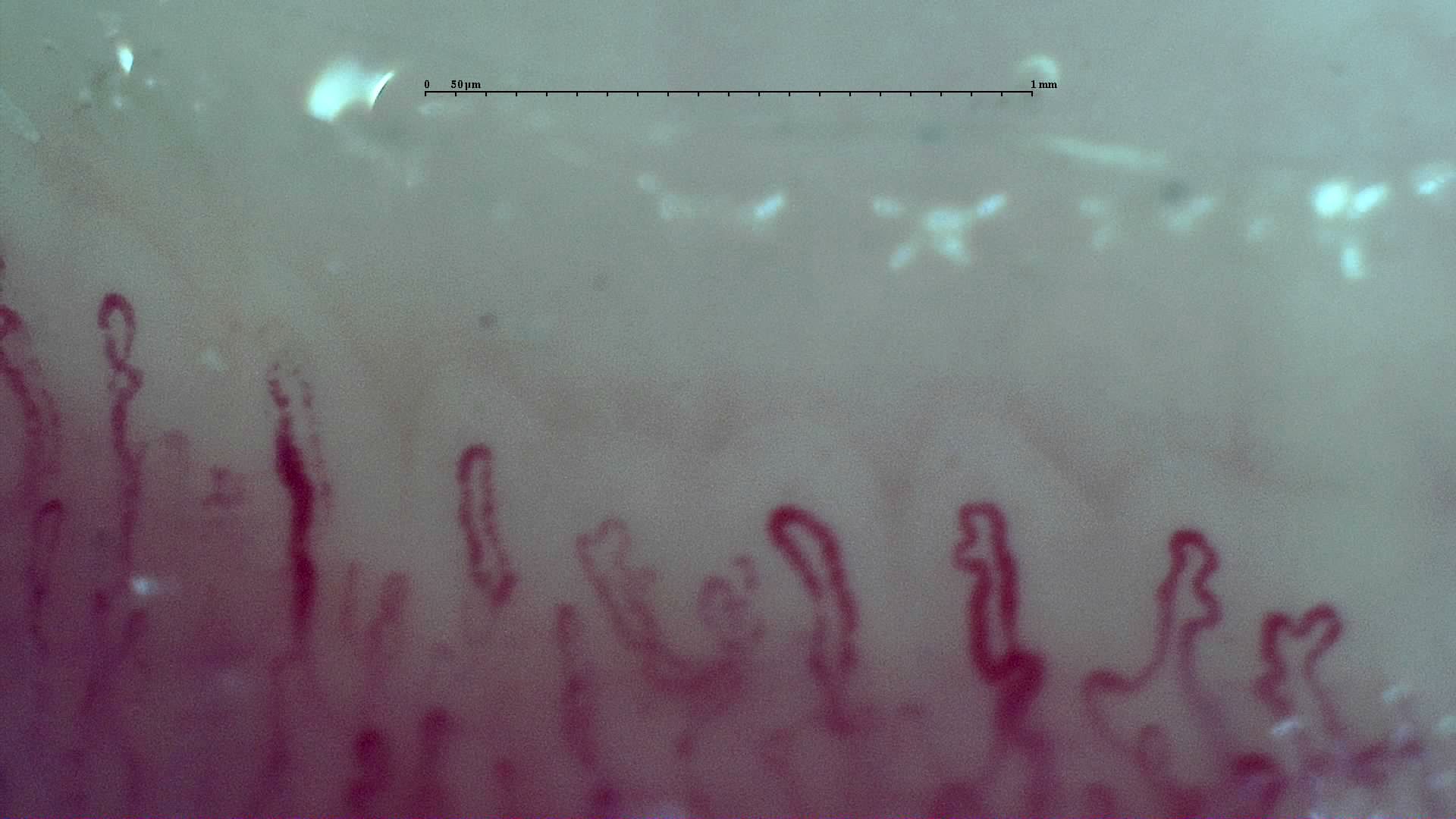 Broad capillaries with lateral bends and folded or hooked apices. Some taller hairpin loops on the left are simpler.