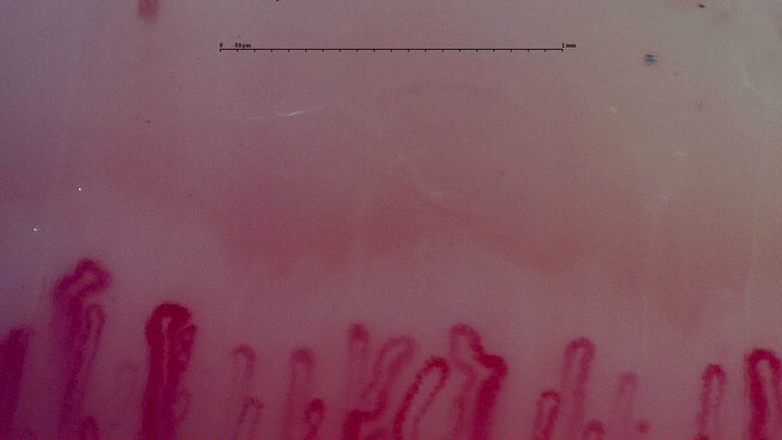An enlarged rounded capillary apex left of center, among narrower and folded loops.