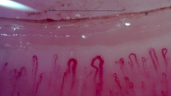 Two enlarged central apices, one rounded and one angular, surrounded by narrower capillaries.
