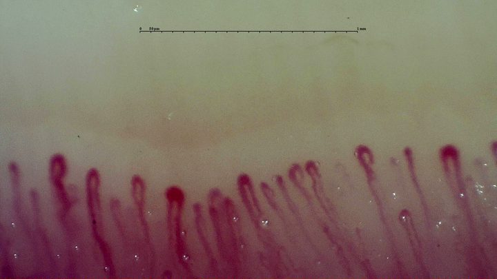 Several enlarged rounded capillary apices with relatively slender limbs, especially near the center-left and right edge.