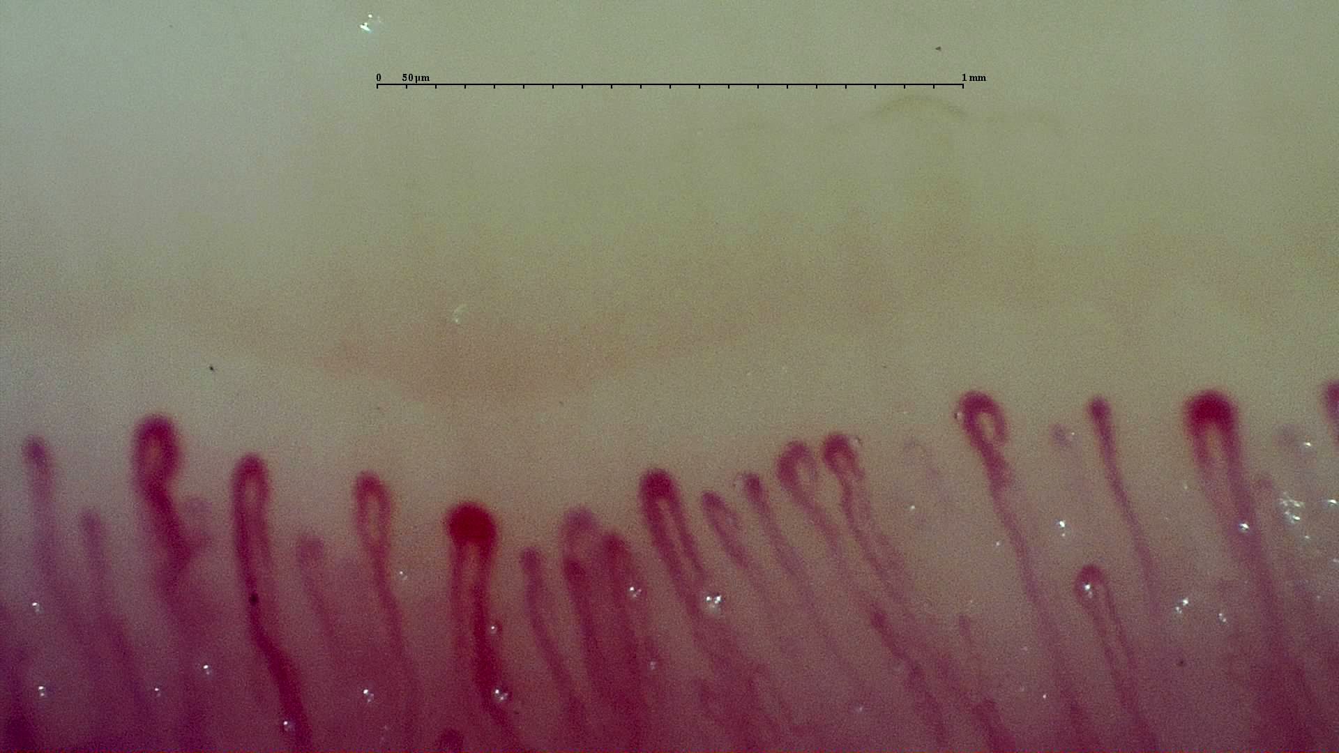 Several enlarged rounded capillary apices with relatively slender limbs, especially near the center-left and right edge.