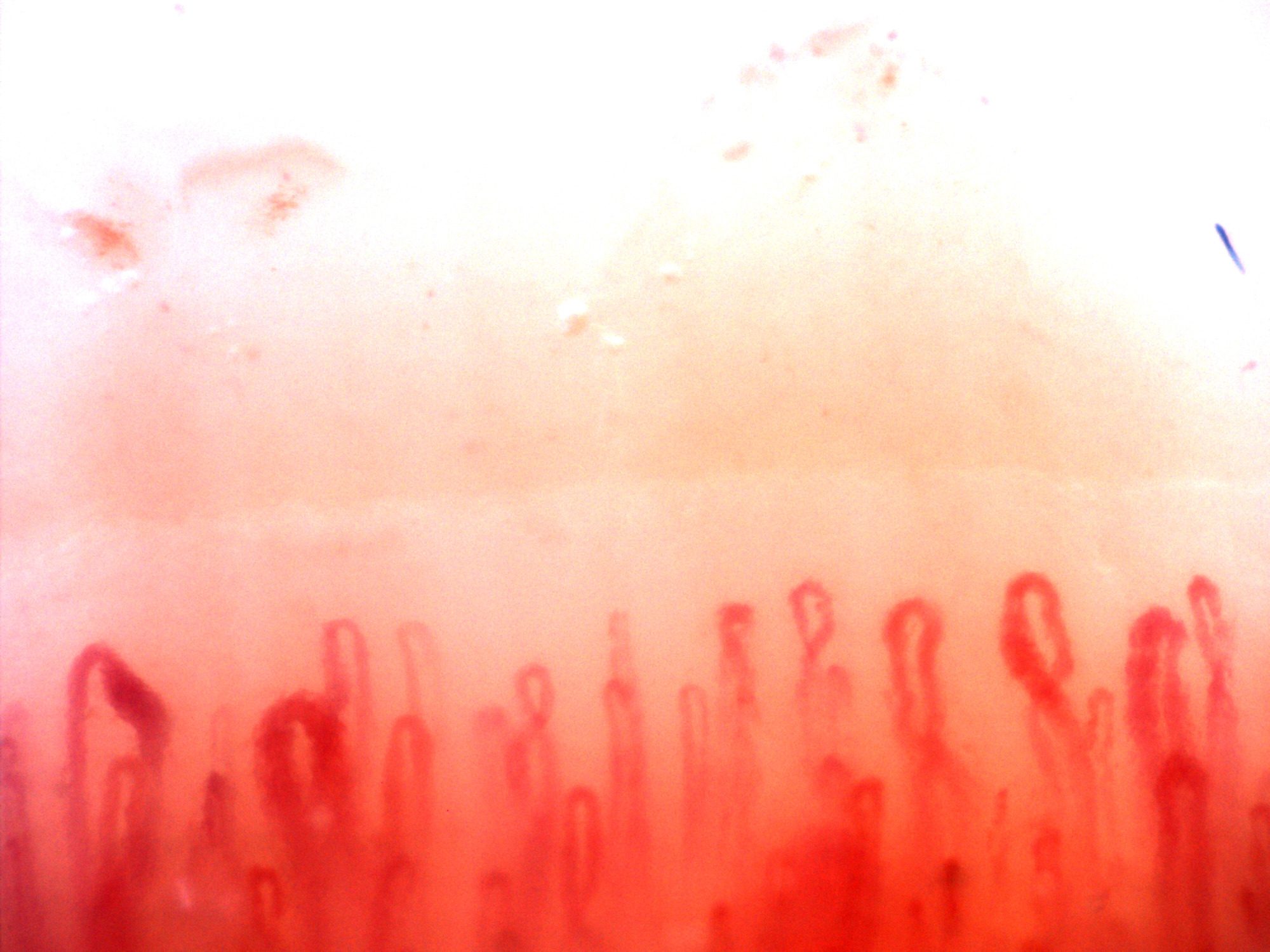 Two giant-appearing capillaries on the left, fine hairpin loops in the center and an oval crossed capillary on the right.