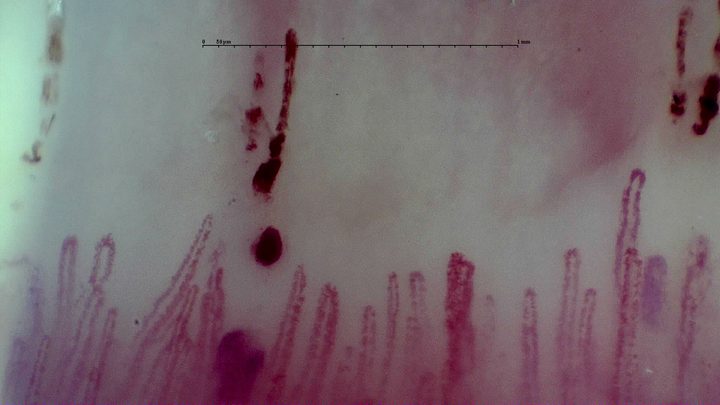 Broad capillaries with elongated and rounded hemorrhagic deposits above the center and right side.