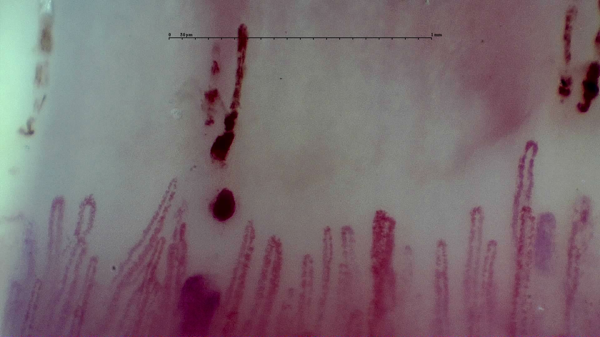 Broad capillaries with elongated and rounded hemorrhagic deposits above the center and right side.