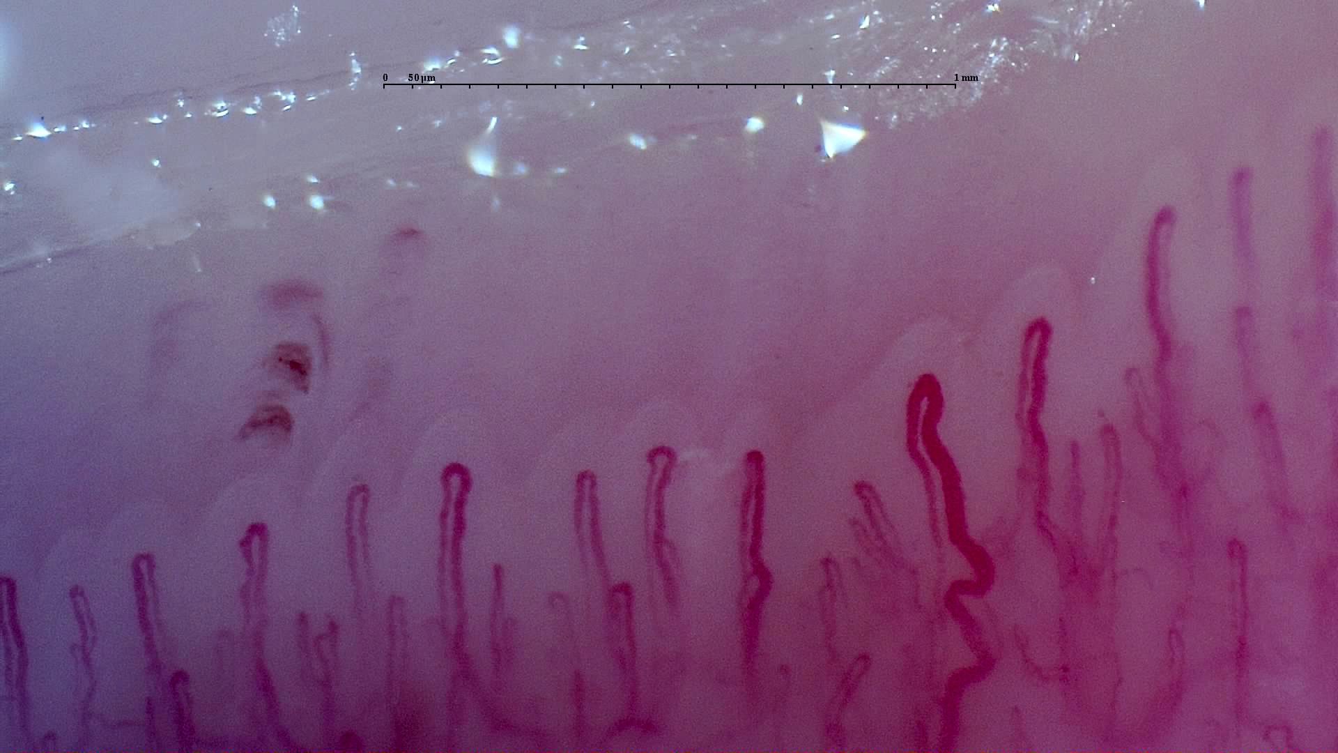 A long tortuous capillary on the right, beside straighter loops. Several small hemorrhagic deposits lie above the left half.