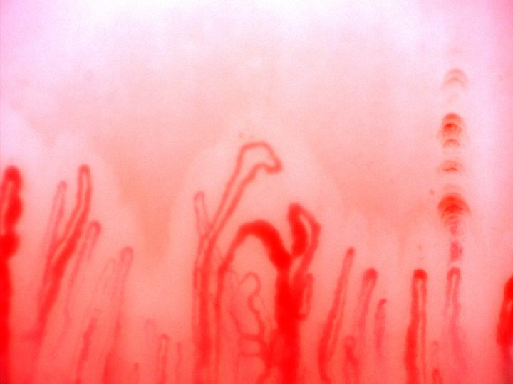 A curved giant-appearing capillary near the center, beside finer and accessory loops. Reddish hemorrhagic deposits lie near the right edge.