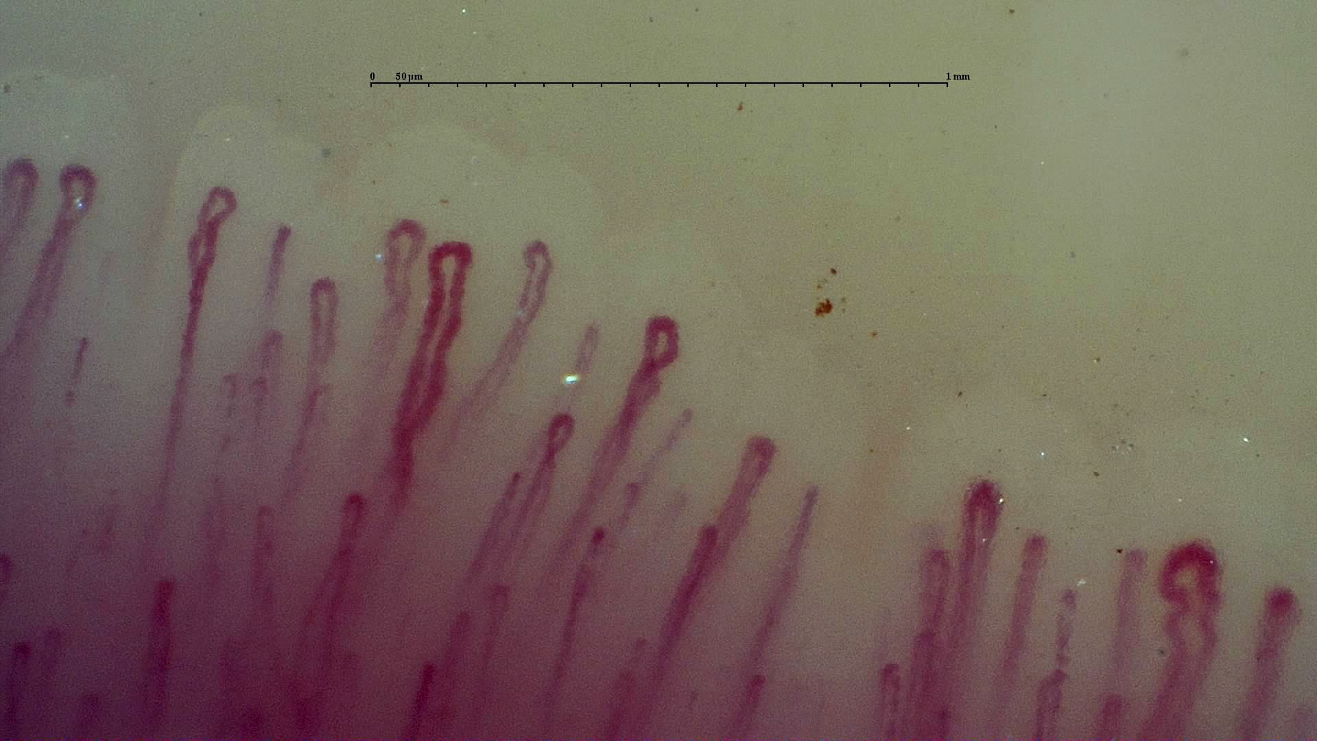 Long hairpin capillaries of different widths, with mild bends and a small oval crossed loop at the right edge.