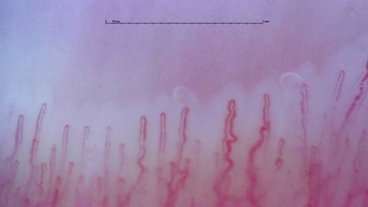 Slender capillaries with rounded apices and mildly tortuous limbs, especially right of center.