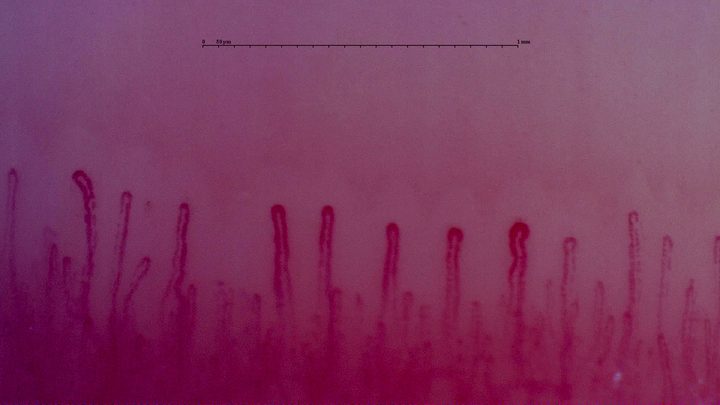 Hairpin capillaries of different widths. One loop right of center has a broader rounded apex.