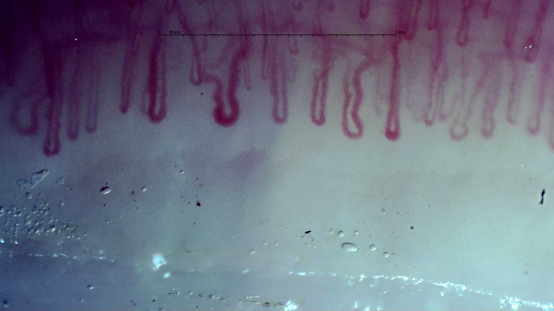 Capillaries with broad U-shaped apices and some tortuous limbs.