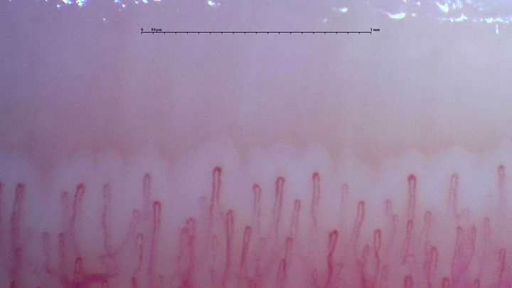 Narrow hairpin capillaries with small differences in length and width.