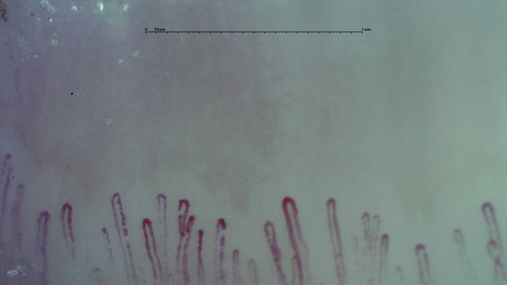 Short hairpin capillaries with rounded apices and variable widths.