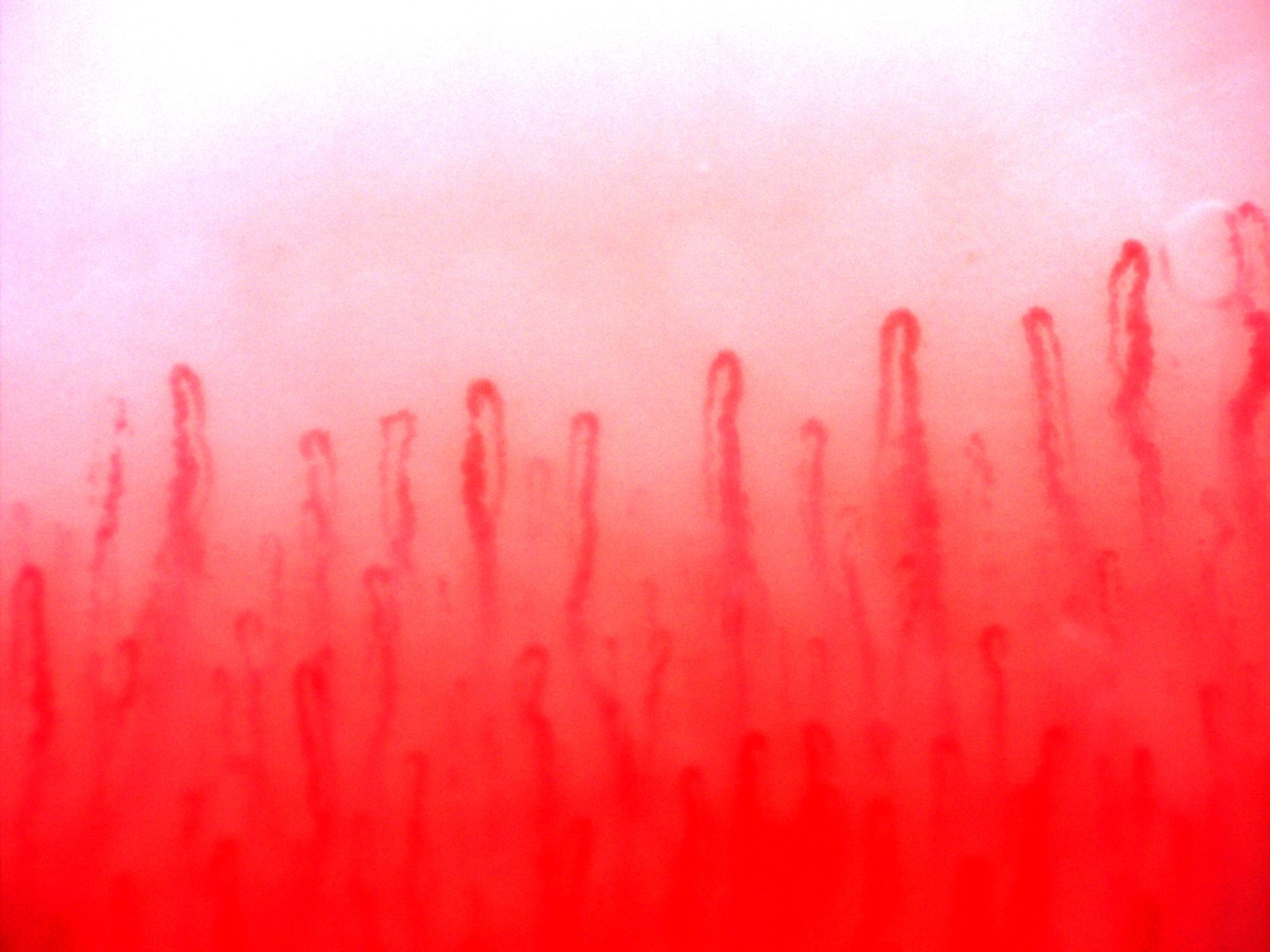 Hairpin capillaries with rounded apices at different heights and mostly aligned limbs.