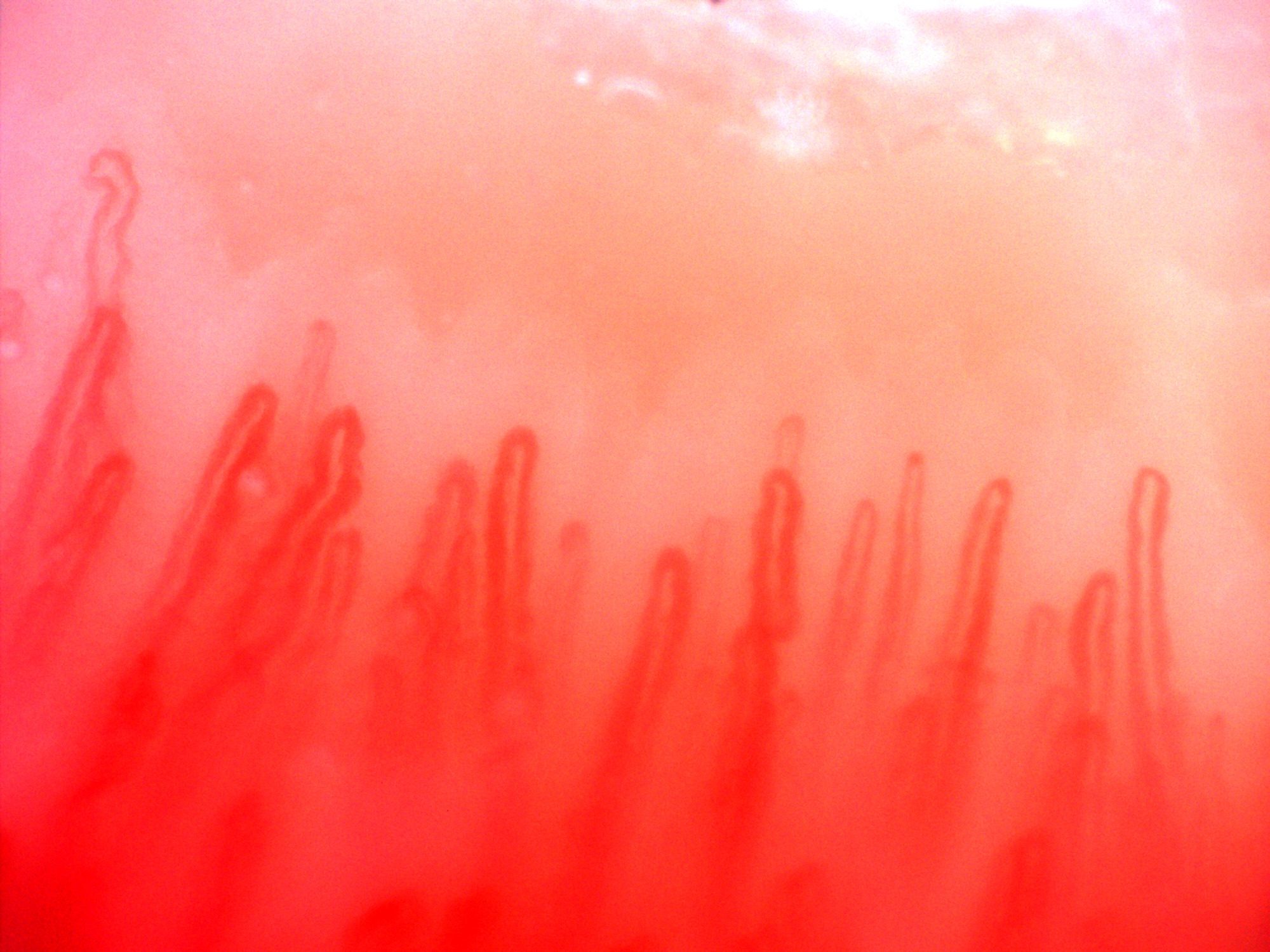 Elongated hairpin capillaries with rounded apices and unequal widths, with broader loops on the left.