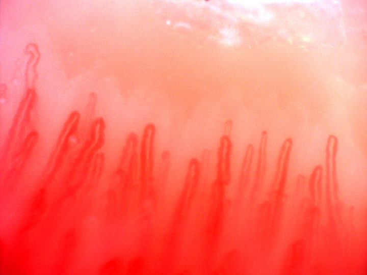 Elongated hairpin capillaries with rounded apices and unequal widths, with broader loops on the left.