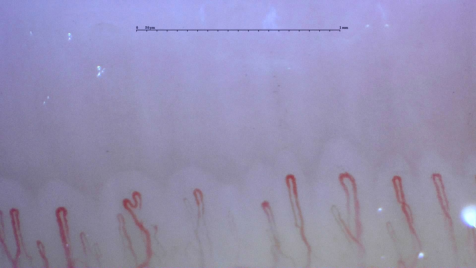 A folded capillary apex left of center, beside taller simple hairpin loops.