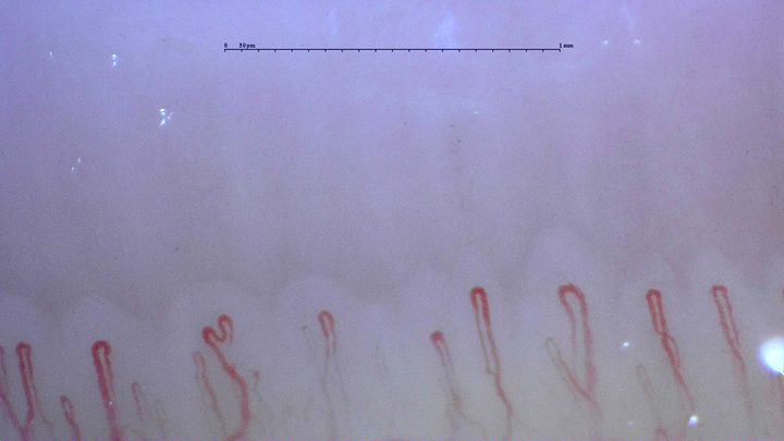 A folded capillary apex left of center, beside taller simple hairpin loops.