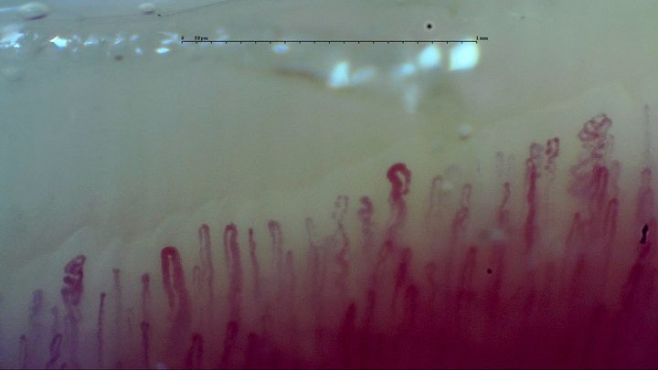Narrow hairpin capillaries, enlarged rounded apices and coiled loops, especially at the right edge.
