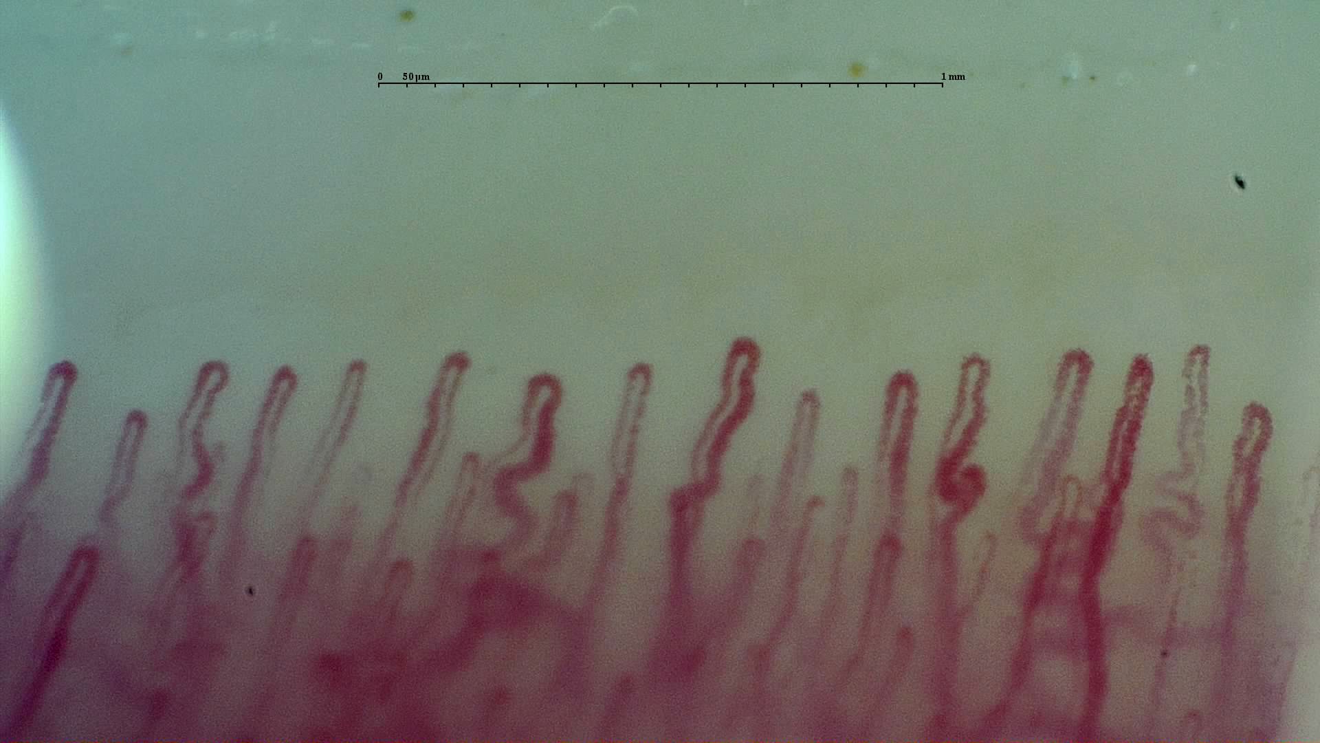 Broad capillaries with rounded apices and marked lateral bends in their limbs, beside straighter hairpin loops.