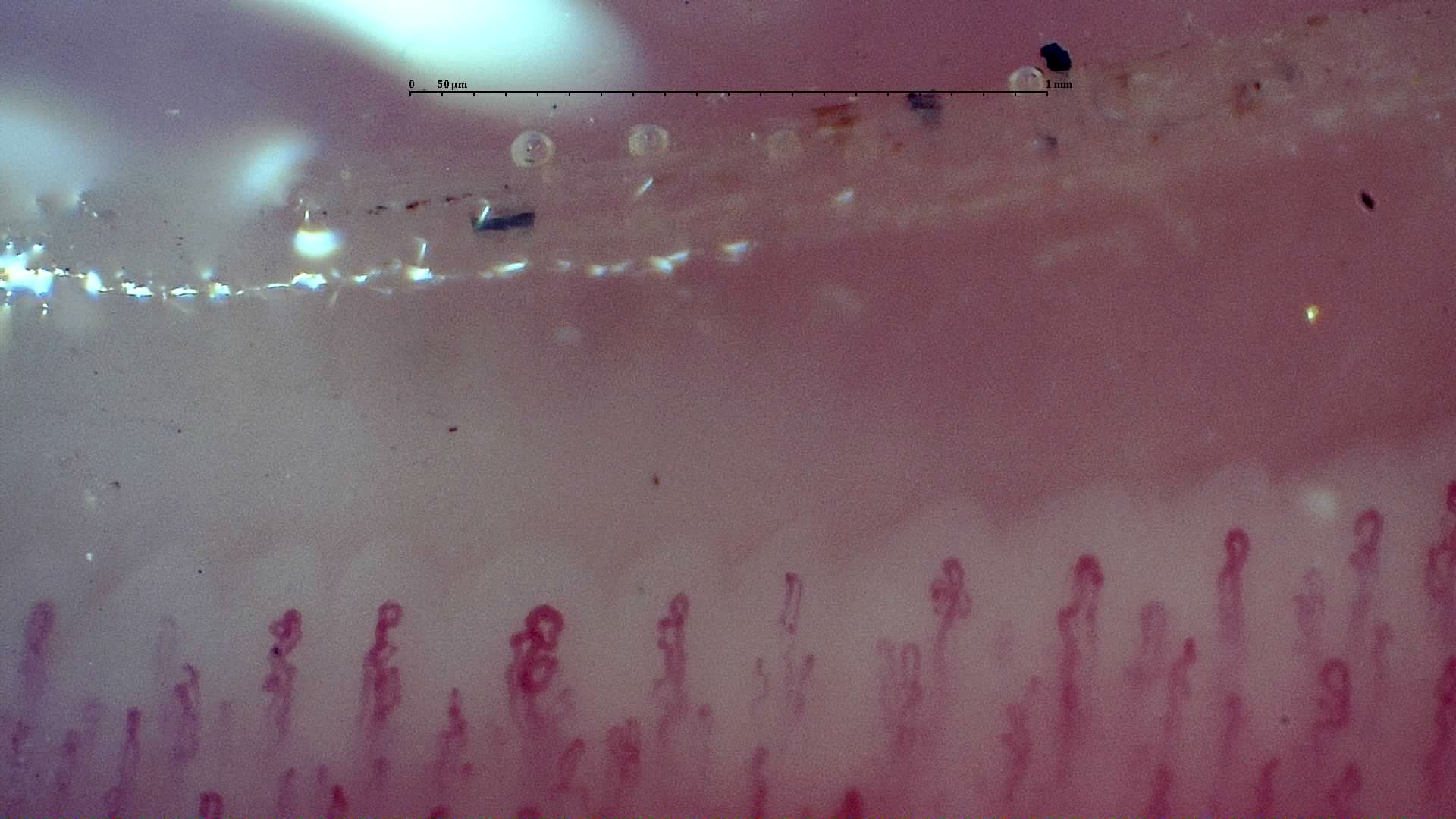 Several coiled or twisted capillary apices, including a loop with two turns near the center-left.
