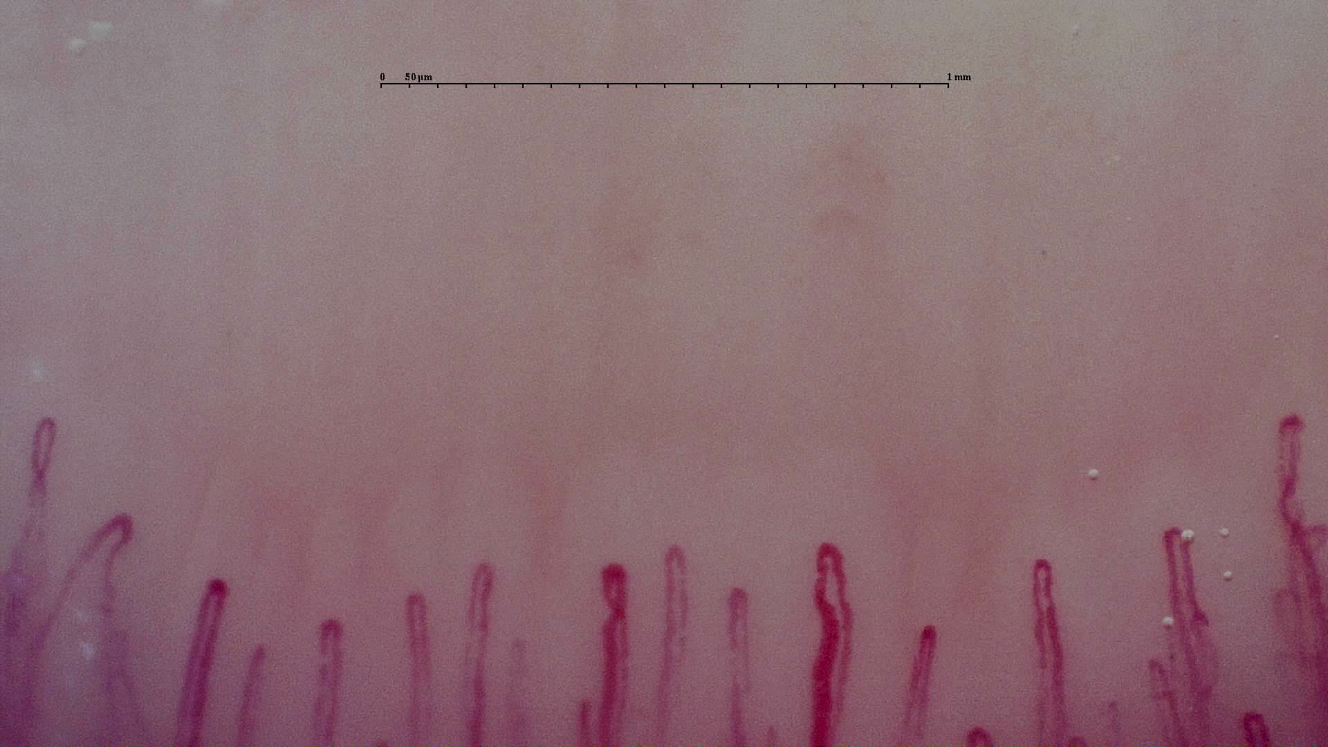 A broad curved capillary right of center, with finer upright loops nearby. Only a narrow part of the capillary row is visible.