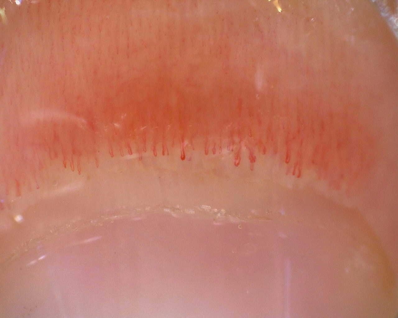 Preview image for Initial study
