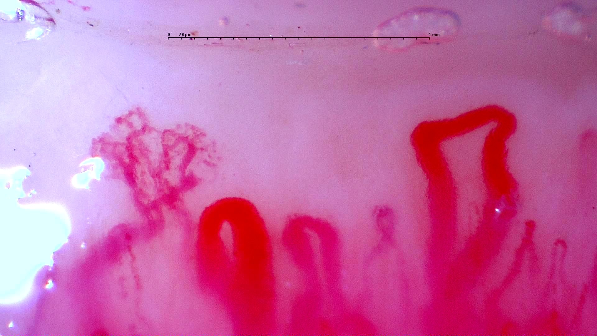 Preview image for Initial study