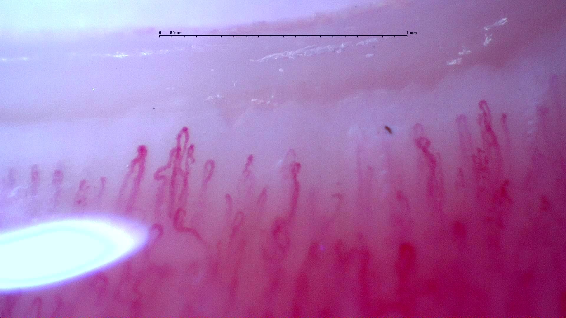 Preview image for Follow-up study