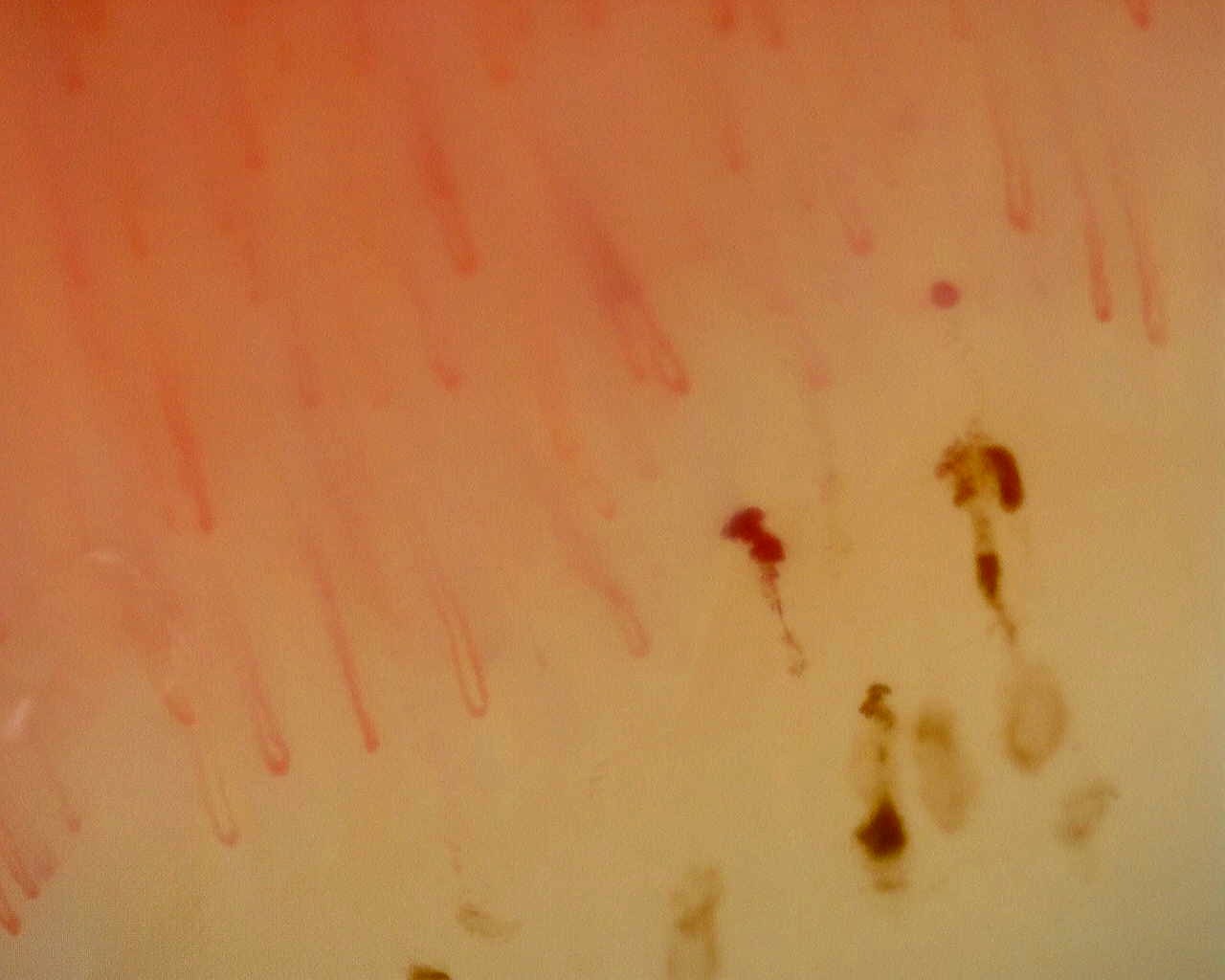 Non-Specific Pattern: Representative Case