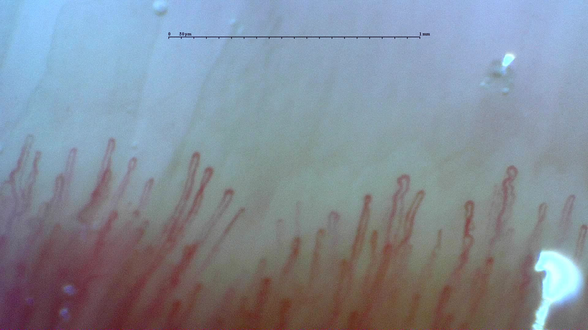 Preview image for Normal Pattern: Representative Case