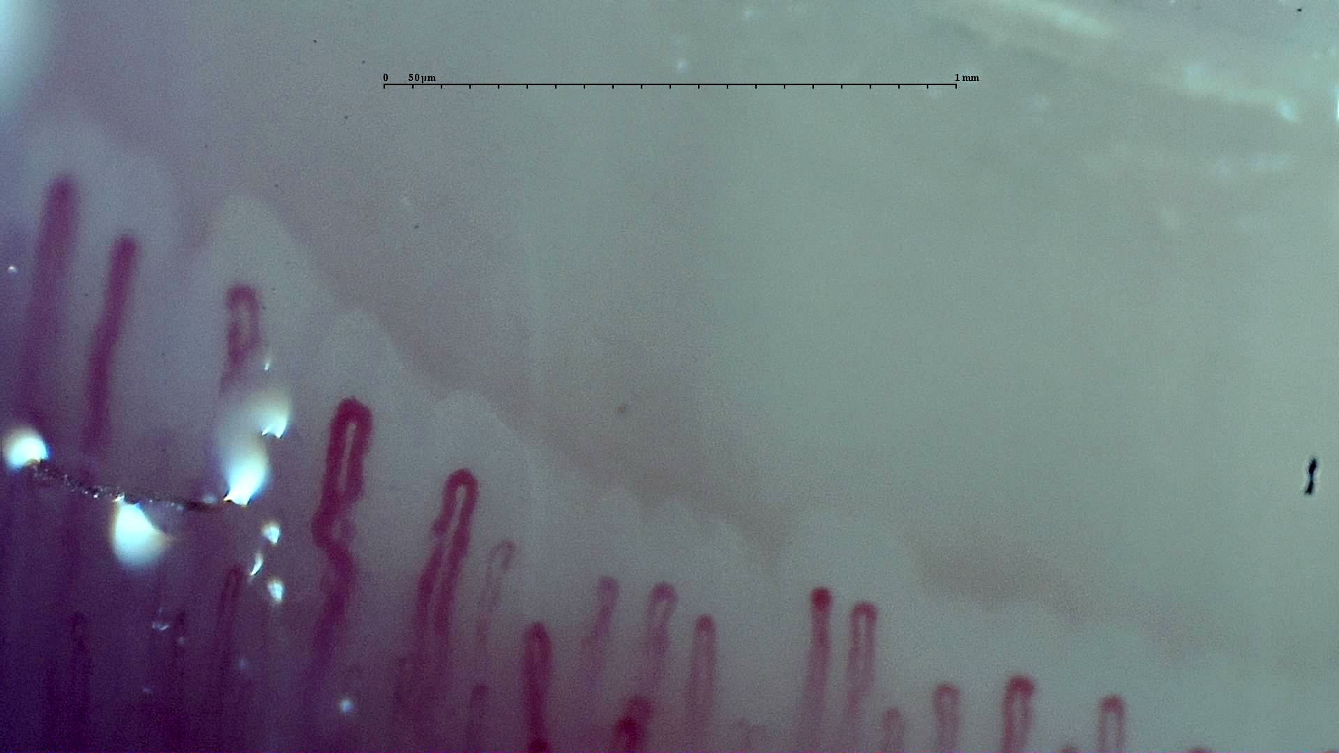 Preview image for Early SSc Cutolo Pattern: Representative Case