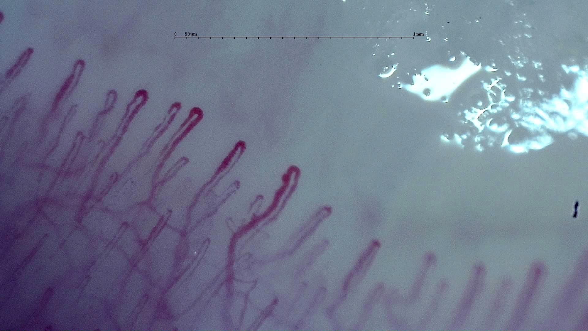 Nailfold capillaroscopy: right middle finger, field a. Early SSc Cutolo Pattern: Representative Case.